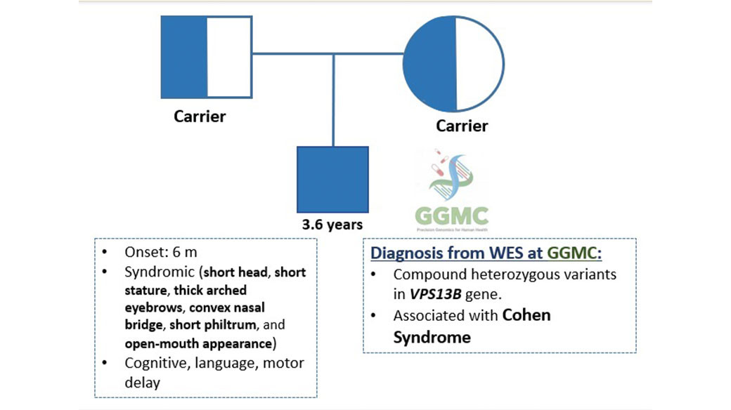 𝐆𝐆𝐌𝐂 কেস রিপোর্ট: শিশুর Cohen Syndrome —যার একটি করে জেনেটিক ত্রুটি বহন করছিলেন বাবা-মা