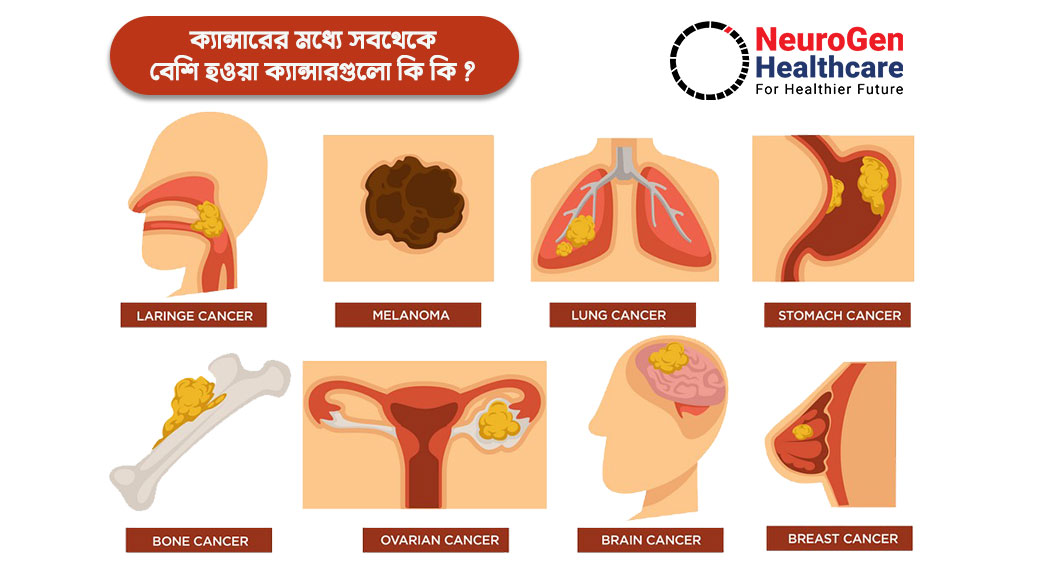 ক্যান্সারের মধ্যে সবথেকে বেশি হওয়া ক্যান্সারগুলো কি কি ?