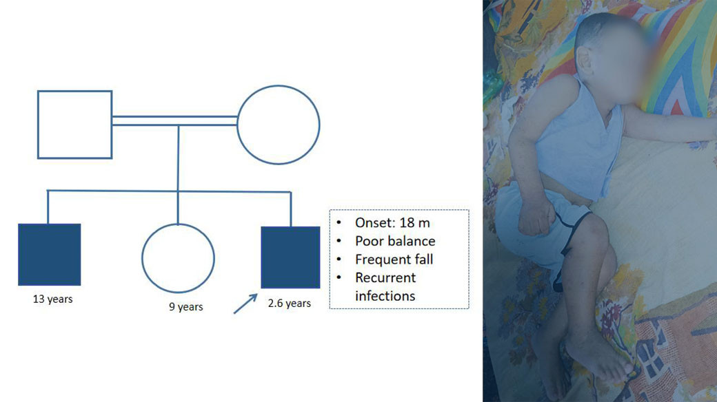 🧬 Ataxia-Telangiectasia (AT): NeuroGen Healthcare-এ নির্ণয় হওয়া একটি বিরল জেনেটিক রোগ !
