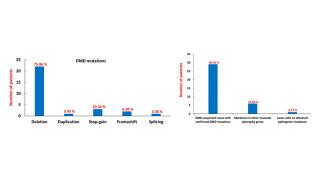 ডিএমডি (DMD) শনাক্তে কয়টি টেস্ট করতে হবে? ডিএমডি ডিলেশন টেস্ট নেগেটিভ হওয়া মানে কি ডিএমডি নেই?